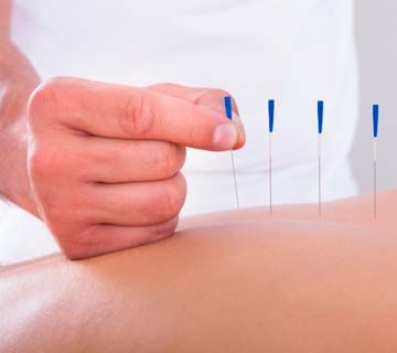 https://clinicagolbanomelendez.com/wp-content/uploads/2025/04/127501-acupuntura.jpg