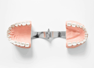 https://clinicagolbanomelendez.com/wp-content/uploads/2025/05/protesis-dental-e1747922026508-320x231.png